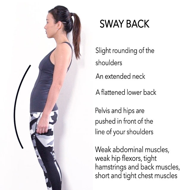 posture sway swayback bad lower exercises shoulder causes neck slight tall improve